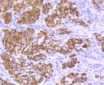 Desmin Antibody in Immunohistochemistry (Paraffin) (IHC (P))