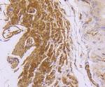 Desmin Antibody in Immunohistochemistry (Paraffin) (IHC (P))