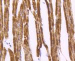 Desmin Antibody in Immunohistochemistry (Paraffin) (IHC (P))