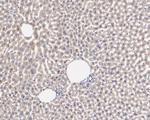 PIK3CA Antibody in Immunohistochemistry (Paraffin) (IHC (P))