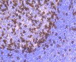 CD279 (PD-1) Antibody in Immunohistochemistry (Paraffin) (IHC (P))