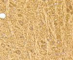 Calmodulin Antibody in Immunohistochemistry (Paraffin) (IHC (P))