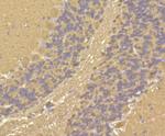 Calmodulin Antibody in Immunohistochemistry (Paraffin) (IHC (P))