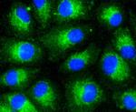 LDLR Antibody in Immunocytochemistry (ICC/IF)