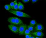 LDLR Antibody in Immunocytochemistry (ICC/IF)