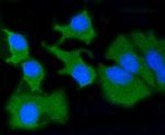 MMP14 Antibody in Immunocytochemistry (ICC/IF)