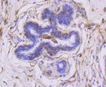 MMP14 Antibody in Immunohistochemistry (Paraffin) (IHC (P))