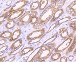 MMP14 Antibody in Immunohistochemistry (Paraffin) (IHC (P))