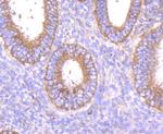 MMP14 Antibody in Immunohistochemistry (Paraffin) (IHC (P))