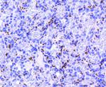 CD61 (Integrin beta 3) Antibody in Immunohistochemistry (Paraffin) (IHC (P))