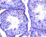 CD61 (Integrin beta 3) Antibody in Immunohistochemistry (Paraffin) (IHC (P))