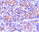 CD61 (Integrin beta 3) Antibody in Immunohistochemistry (Paraffin) (IHC (P))