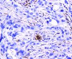 CD61 (Integrin beta 3) Antibody in Immunohistochemistry (Paraffin) (IHC (P))