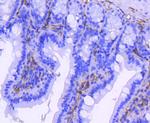 CD61 (Integrin beta 3) Antibody in Immunohistochemistry (Paraffin) (IHC (P))