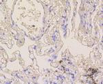 NOTCH1 Antibody in Immunohistochemistry (Paraffin) (IHC (P))