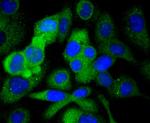 Paxillin Antibody in Immunocytochemistry (ICC/IF)