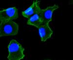 NOX4 Antibody in Immunocytochemistry (ICC/IF)