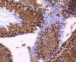 TOP2A Antibody in Immunohistochemistry (Paraffin) (IHC (P))