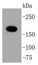 TOP2A Antibody in Western Blot (WB)