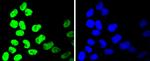 HDAC2 Antibody in Immunocytochemistry (ICC/IF)