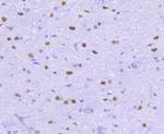 HDAC2 Antibody in Immunohistochemistry (Paraffin) (IHC (P))