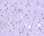 HDAC2 Antibody in Immunohistochemistry (Paraffin) (IHC (P))