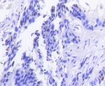 Rb Antibody in Immunohistochemistry (Paraffin) (IHC (P))