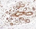 Phospho-HSF1 (Ser326) Antibody in Immunohistochemistry (Paraffin) (IHC (P))