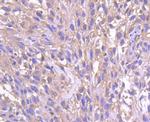 Phospho-HSF1 (Ser326) Antibody in Immunohistochemistry (Paraffin) (IHC (P))