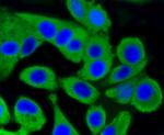 PKC alpha Antibody in Immunocytochemistry (ICC/IF)