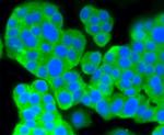 PKC alpha Antibody in Immunocytochemistry (ICC/IF)