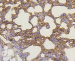 BAK Antibody in Immunohistochemistry (Paraffin) (IHC (P))