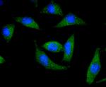 DARPP-32 Antibody in Immunocytochemistry (ICC/IF)