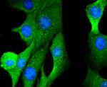 FOXO1 Antibody in Immunocytochemistry (ICC/IF)