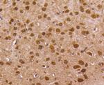 FOXO1 Antibody in Immunohistochemistry (Paraffin) (IHC (P))