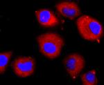 CD309 (FLK1) Antibody in Immunocytochemistry (ICC/IF)