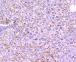 TrkA Antibody in Immunohistochemistry (Paraffin) (IHC (P))