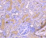 TrkA Antibody in Immunohistochemistry (Paraffin) (IHC (P))