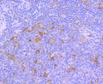 TrkA Antibody in Immunohistochemistry (Paraffin) (IHC (P))