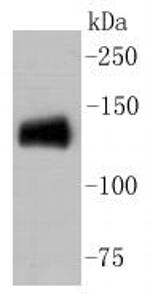 CD31 (PECAM-1) Antibody in Western Blot (WB)