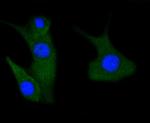 Phospho-PAK1/2/3 (Ser144, Ser141, Ser139) Antibody in Immunocytochemistry (ICC/IF)