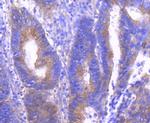 Phospho-PAK1/2/3 (Ser144, Ser141, Ser139) Antibody in Immunohistochemistry (Paraffin) (IHC (P))