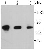 Phospho-PAK1/2/3 (Ser144, Ser141, Ser139) Antibody in Western Blot (WB)