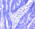 p16INK4a Antibody in Immunohistochemistry (Paraffin) (IHC (P))