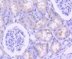 p16INK4a Antibody in Immunohistochemistry (Paraffin) (IHC (P))