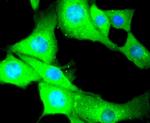 MYLK Antibody in Immunocytochemistry (ICC/IF)