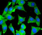 MYLK Antibody in Immunocytochemistry (ICC/IF)