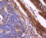 MYLK Antibody in Immunohistochemistry (Paraffin) (IHC (P))