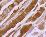 MYLK Antibody in Immunohistochemistry (Paraffin) (IHC (P))