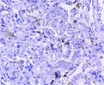 M-CSF Antibody in Immunohistochemistry (Paraffin) (IHC (P))